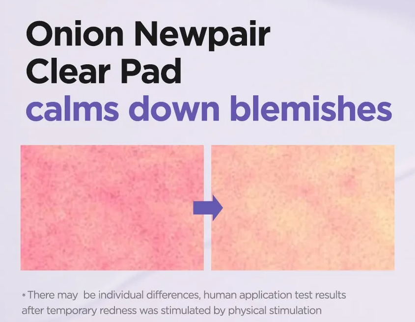 Isntree - Discos de Algodón Onion Newpair Clear Pad