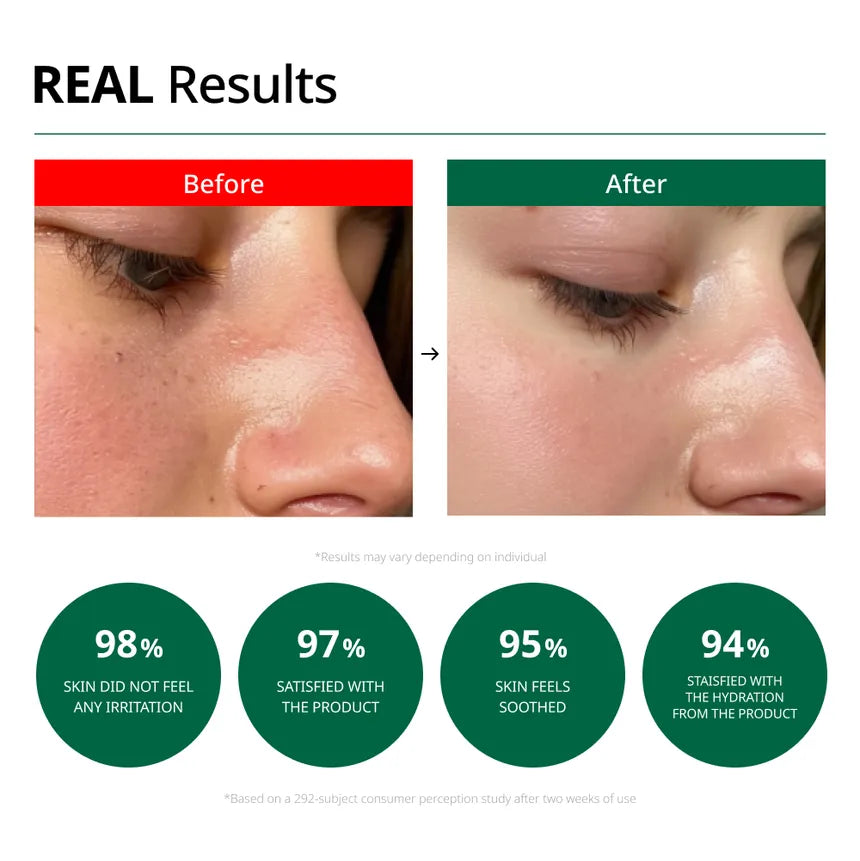 Dr.G - R.E.D Blemish Clear Soothing Cream (Crema Reparadora Calmante) (70 ml)