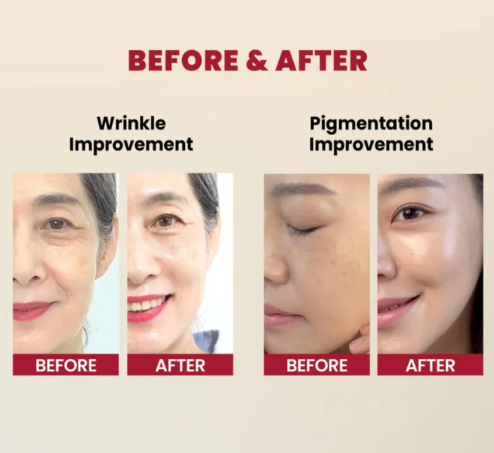 KSECRET - SEOUL 1988 Serum Facial – Retinal Liposome 2% + Ginseng Negro (30ml) [prt-195]