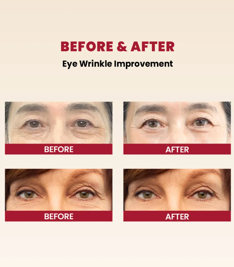 KSECRET – SEOUL 1988 Crema Contorno de Ojos Eye Cream (Retinal Liposome 4% + Fermented Bean)