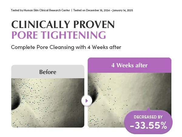 EQQUALBERRY Purple PDRN Pore Minimizing Serum – Sérum Minimizador de Poros con PDRN Morado [prt-246]