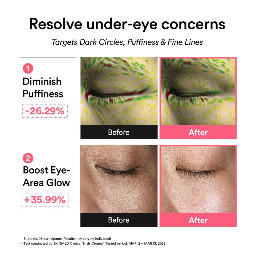 Abib PDRN Retinal Eye Patch Glow Jelly – Parches de Ojos con PDRN y Retinal [prt-254]